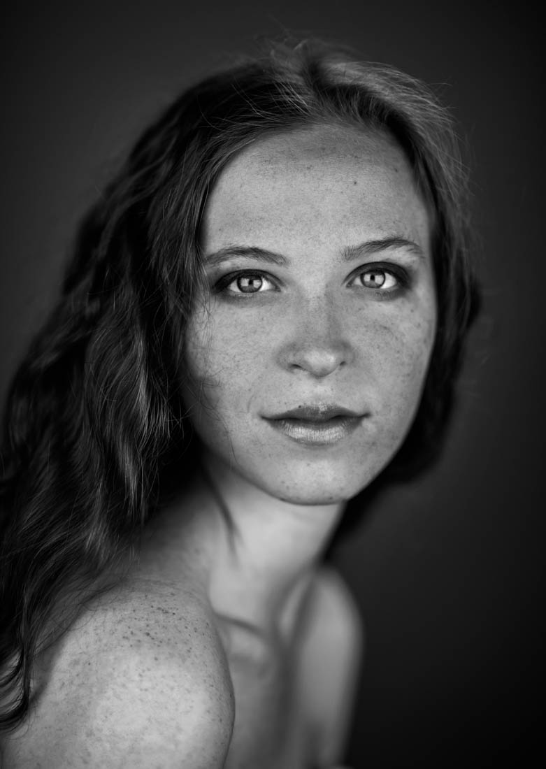 Freckles
