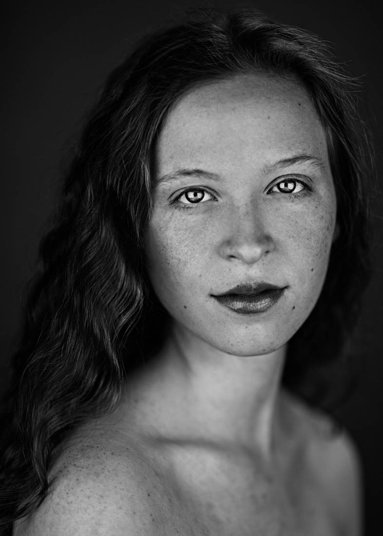 Freckles