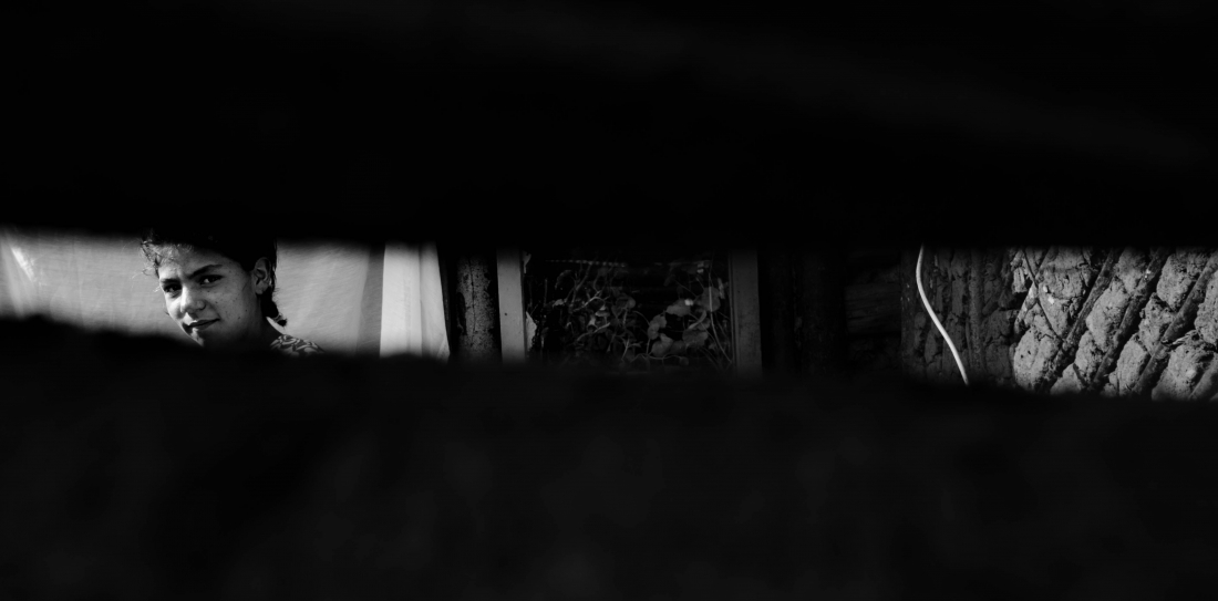 Skin and language. The double burden