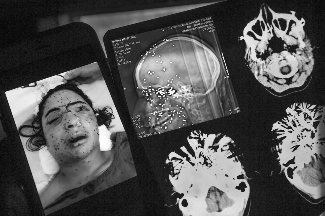 Kashmir: Blinded by Conflict 