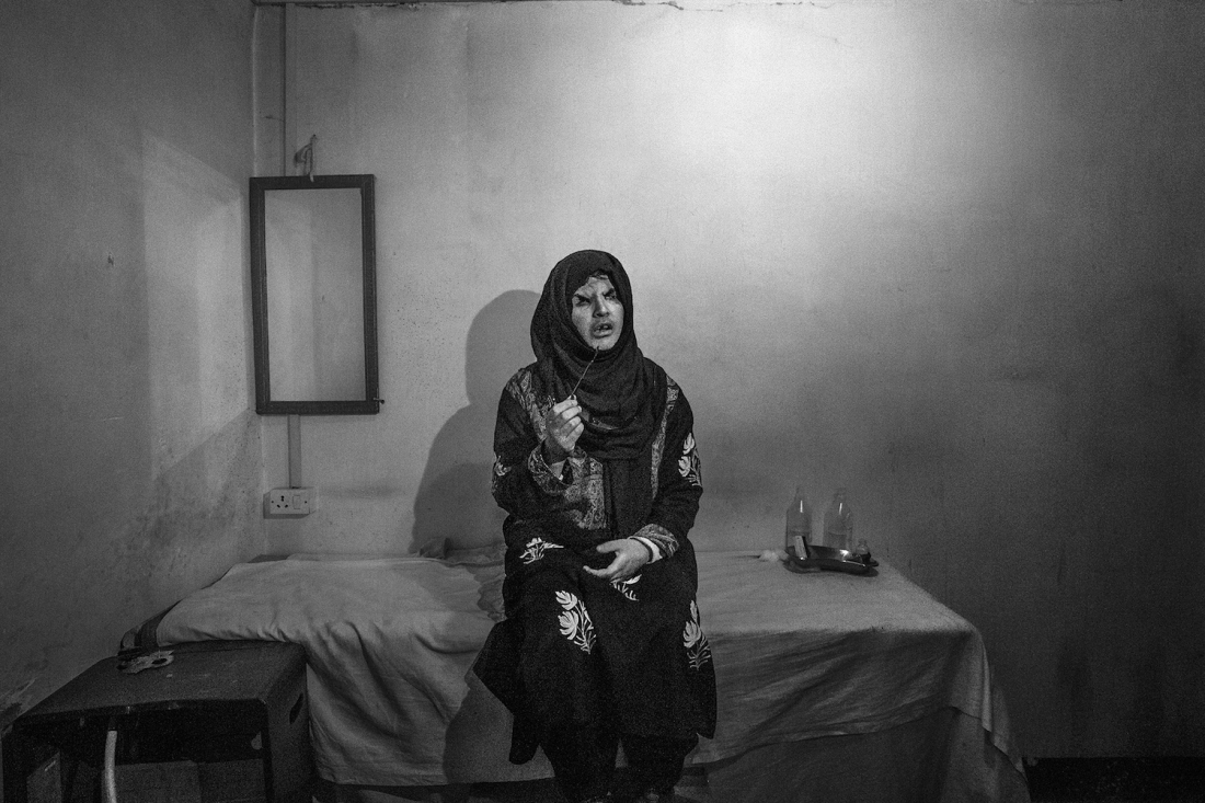 Kashmir: Blinded by Conflict 