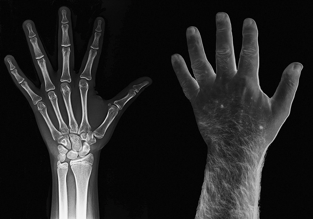 WHAT YOU ARE, WE WERE