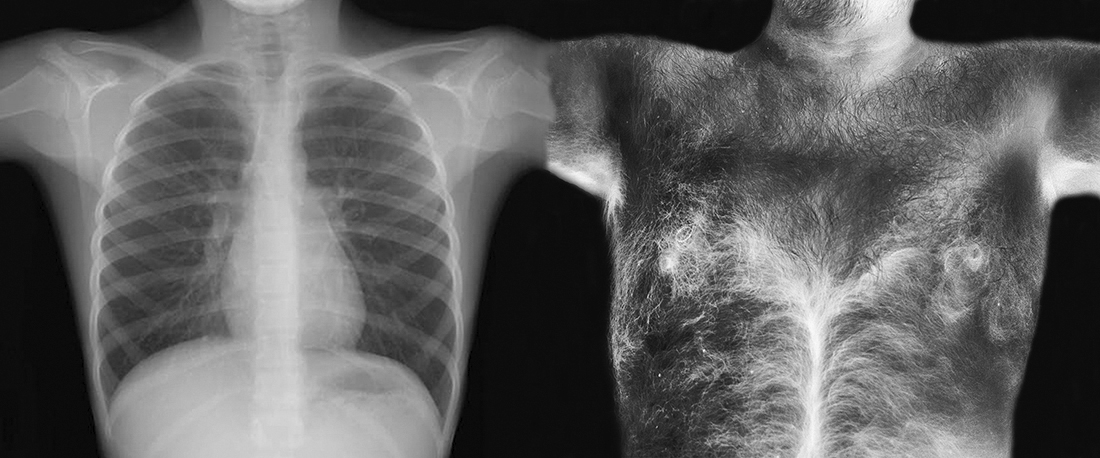 WHAT YOU ARE, WE WERE