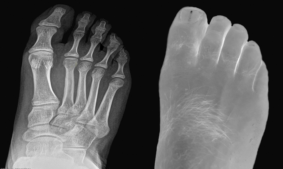 WHAT YOU ARE, WE WERE