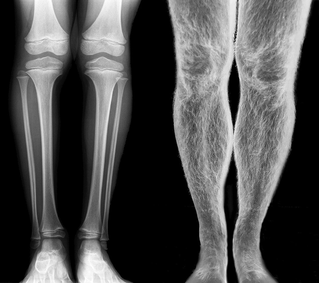 WHAT YOU ARE, WE WERE