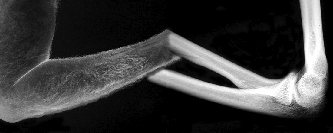 WHAT YOU ARE, WE WERE