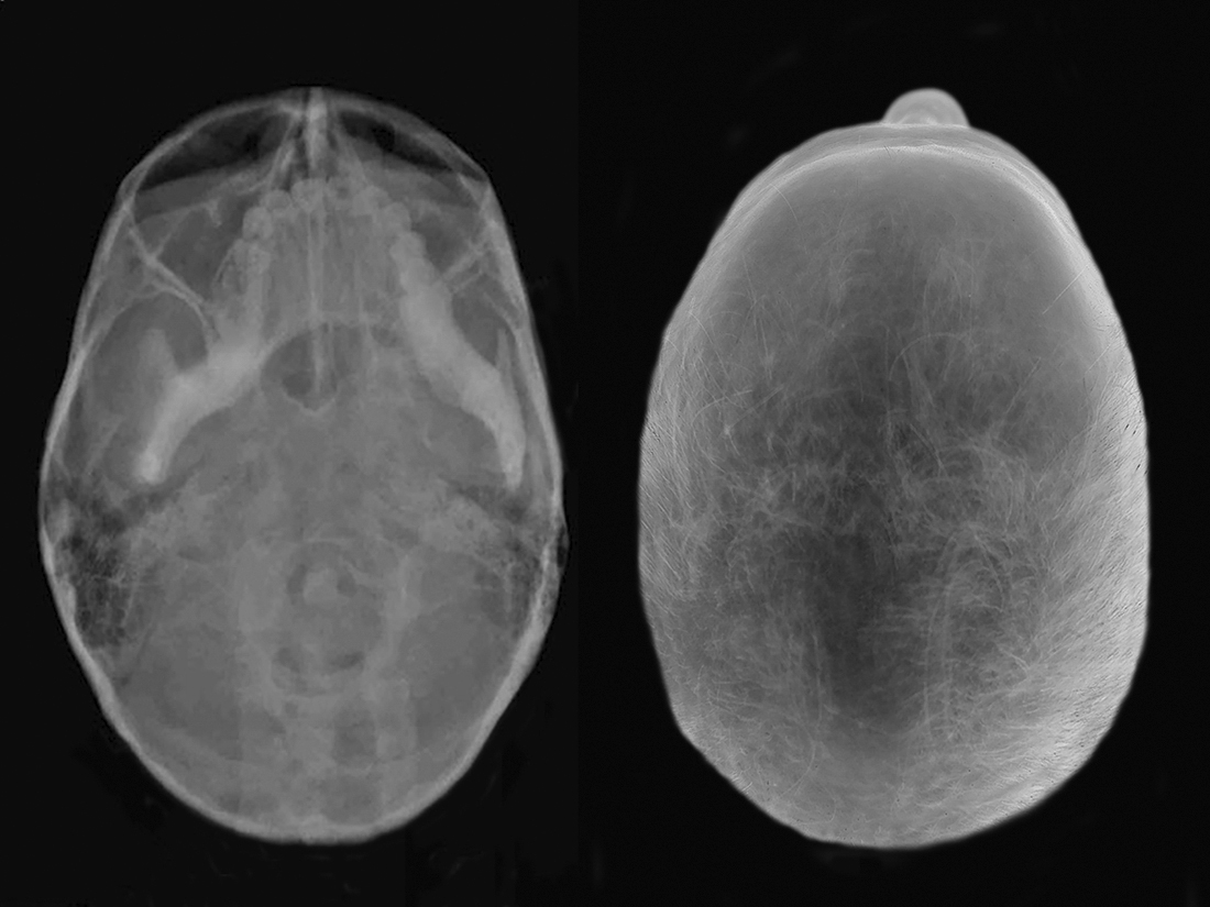 WHAT YOU ARE, WE WERE