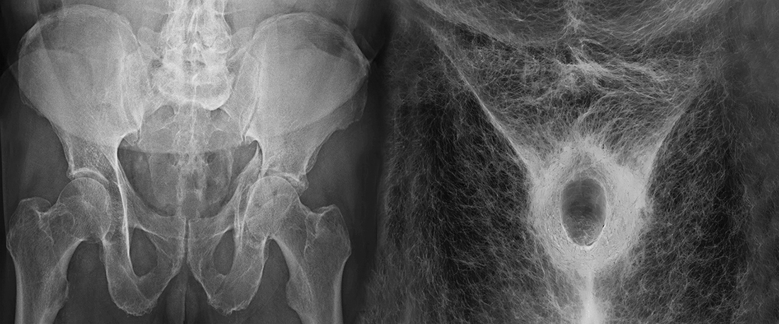 WHAT YOU ARE, WE WERE