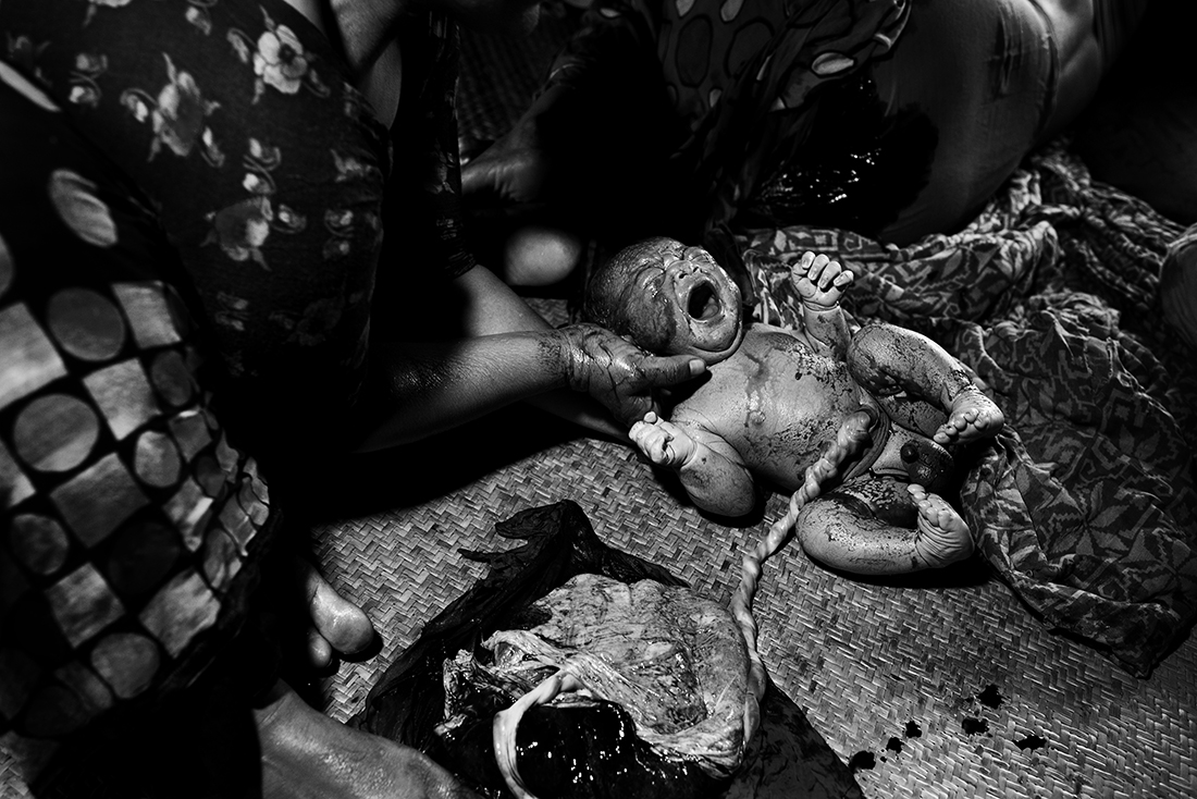 Survivor-Survived against all the odds