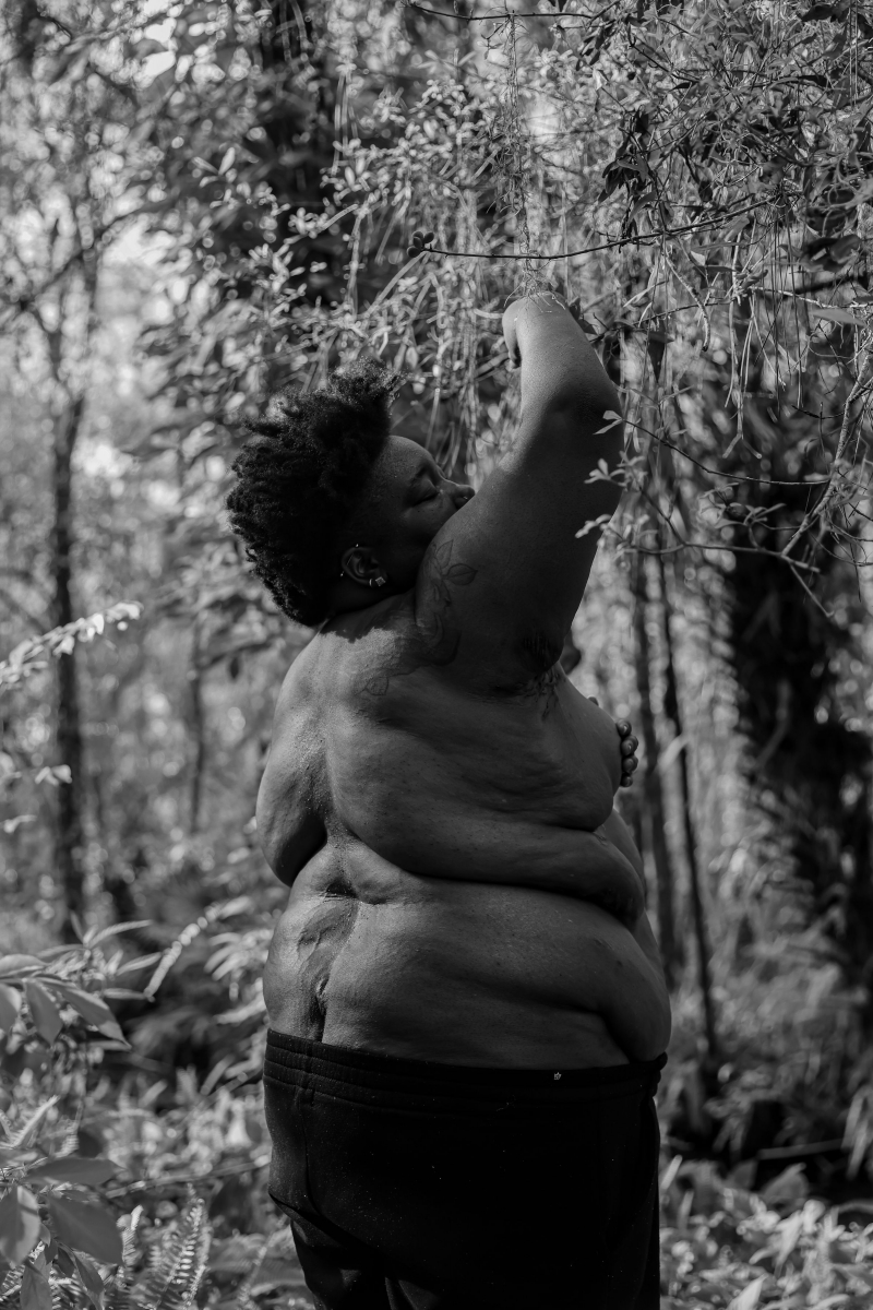 SKIN (The Scars that Remind)