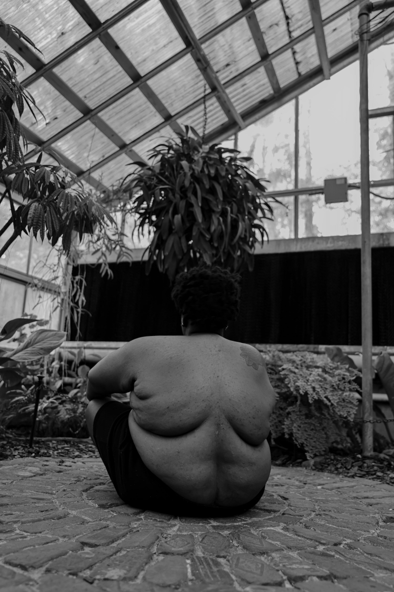 SKIN (The Scars that Remind)