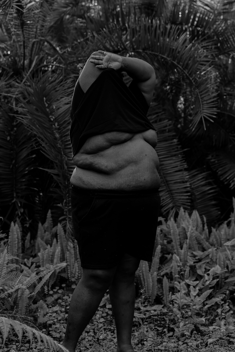 SKIN (The Scars that Remind)