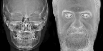 WHAT YOU ARE, WE WERE