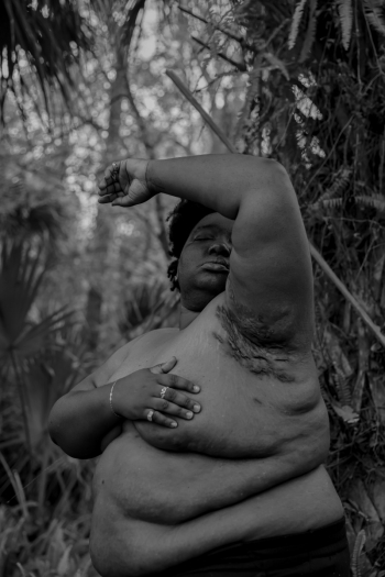 SKIN (The Scars that Remind)